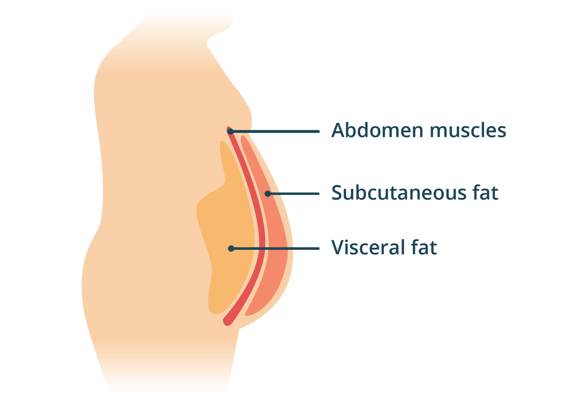 Visceral Fat Intervention Map - health coaching intervention guide